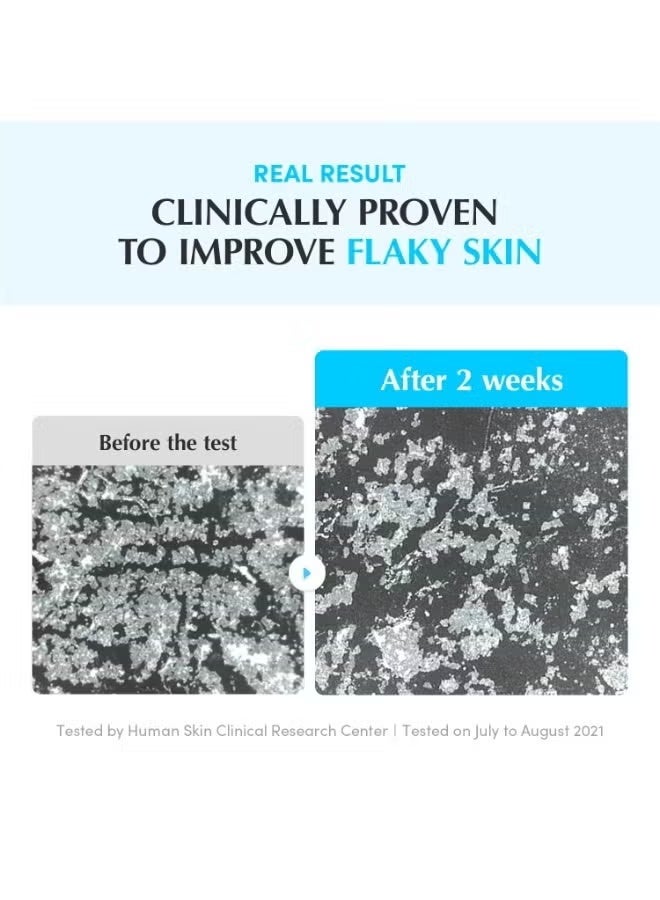 eqqualberry Swimming Pool Toner - Gentle Exfoliating Toner with Natural Enzyme | Boosted Hydration with Hyaluronic Acid | Daily Toner for Sensitive Skin | Korean Skincare, 10.14 Fl. Oz / 300ml - Image 4